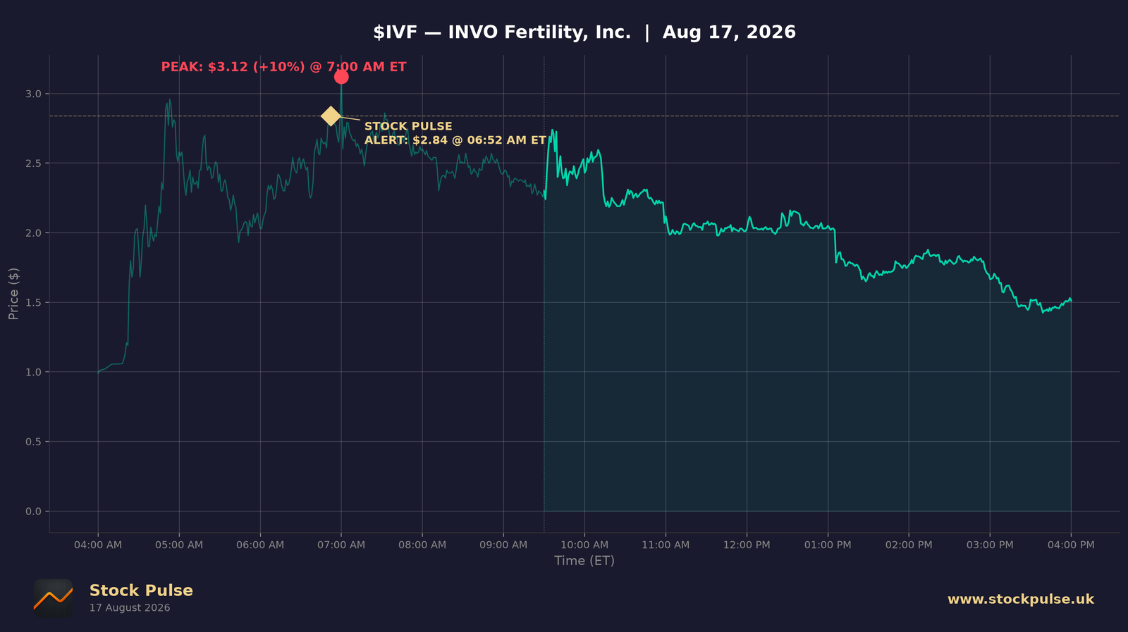 IVF intraday chart, Aug 17, 2026